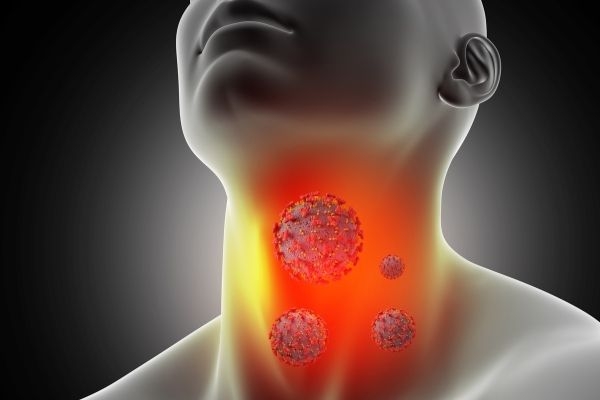 Ung thư vòm họng là gì? Nguyên nhân, dấu hiệu, cách phòng ngừa tại nhà